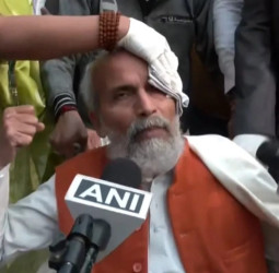 बीजेपी सांसद प्रताप सरंगी को लगी चोट, बोले– राहुल गांधी ने धक्का मारा।